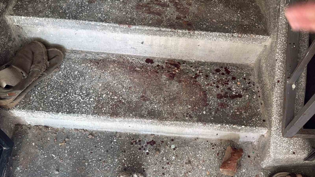 Eskişehir’de 2’si polis 9 kişinin yaralandığı kavganın görüntüleri ortaya çıktı