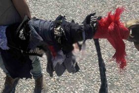 Traktör şaftına kolunu kaptıran kadın ağır yaralandı
