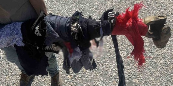Sivrihisar’da traktör şaftına kolunu kaptıran kadın ağır yaralandı